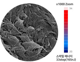 아이리움안과 스마일수술은 ‘로우에너지 스마일’입니다.