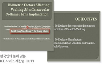 아쿠아렌즈삽입술 후 결과는? 수술 전 검사과정에서 찾을 수 있다!