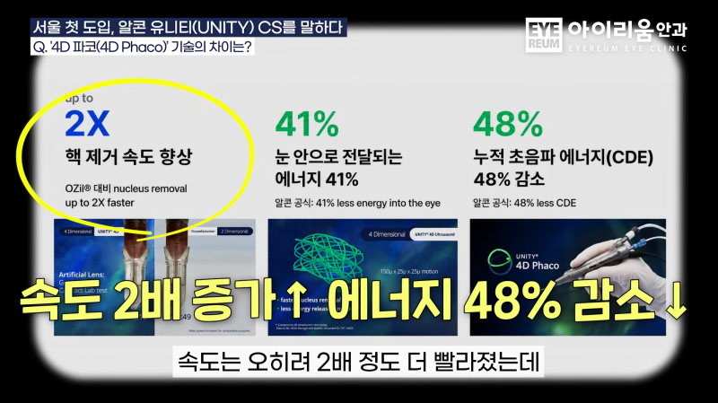 백내장수술, 더 편안하고 안정적인 수술을 위한, 로우에너지 백내장수술