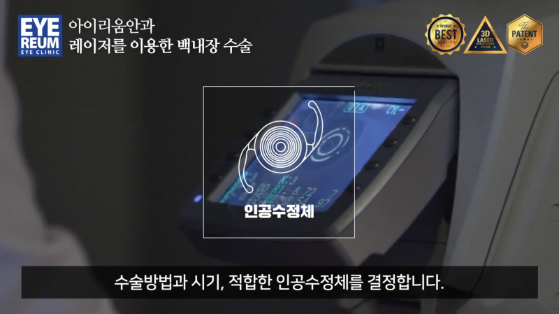 백내장수술, 언제 해야 할까요? 시력보다 중요한 '수술 시기'와 정밀검사 사진 10
