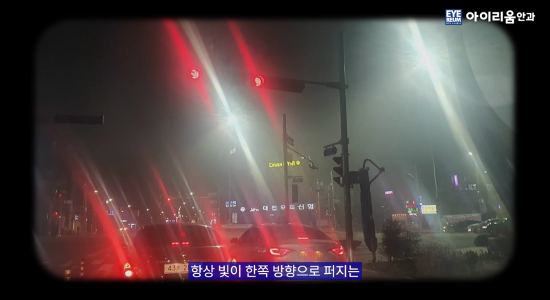 20년 전 라식했다면? 라식 1세대의 백내장수술은 달라야 합니다. 사진 4
