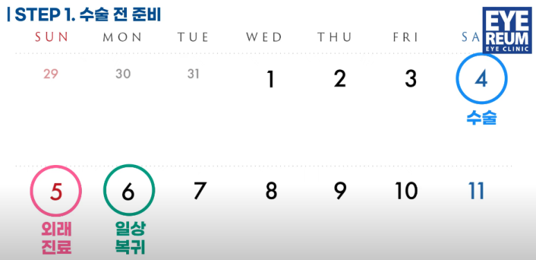 직장인 원데이스마일라식 Q&A - 연차부터 수술준비까지 사진 8