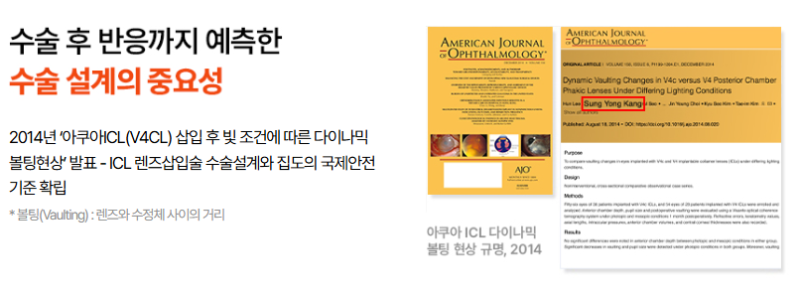 추석 ICL 렌즈삽입술, 원하는 날짜에 수술하려면 미리 검사해야 하는 이유 사진 5